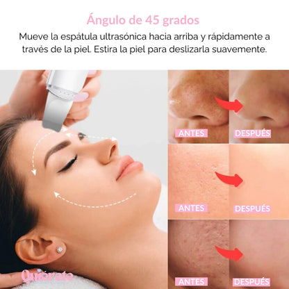 ¡Oferta por tiempo limitado! UltraCleanse Pro™ Tu llave a una piel radiante y sin imperfecciones